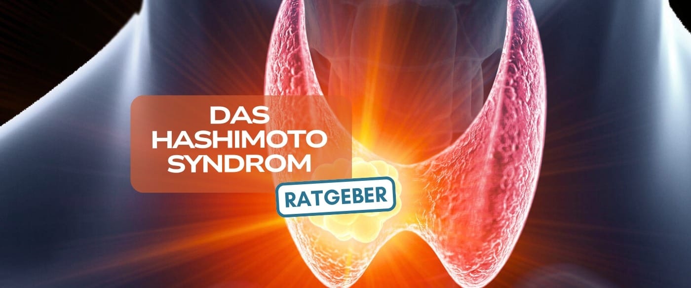Ratgeber Hashimoto